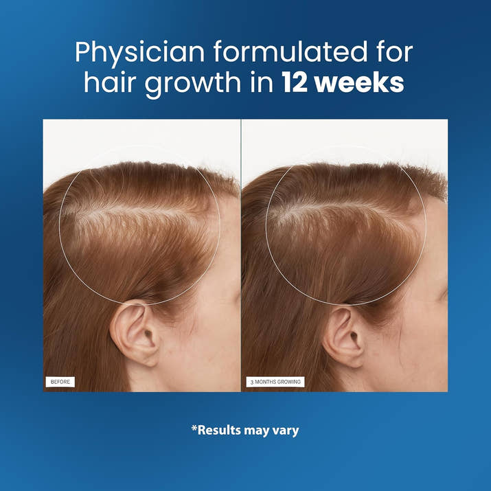 Rosemary Hair Growth Serum Roll On