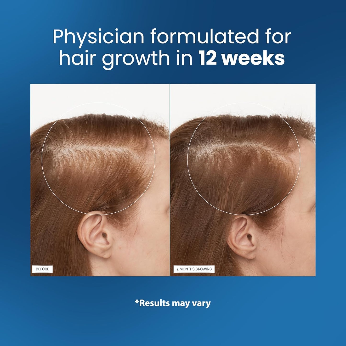 Rosemary Hair Growth Serum Roll On